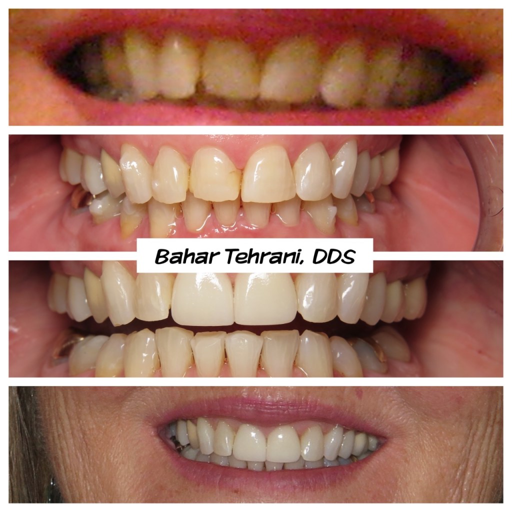 before and after images