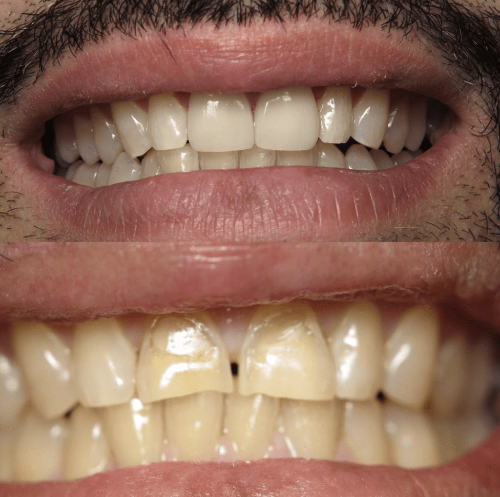 before and after pictures